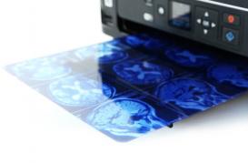 Как распечатать рентгеновский снимок на струйном принтере?